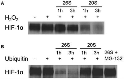 Relative Contribution of Prolyl Hydroxylase-Dependent and -Independent Degradation of HIF-1alpha by Proteasomal Pathways in Cerebral Ischemia